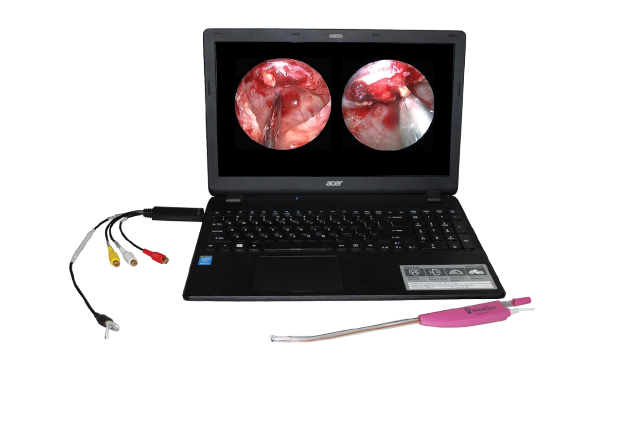 MedGyn Endoscopic Cannula (1)